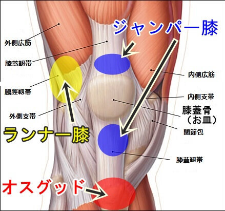 ジャンパー膝 膝蓋骨靭帯炎 の施術